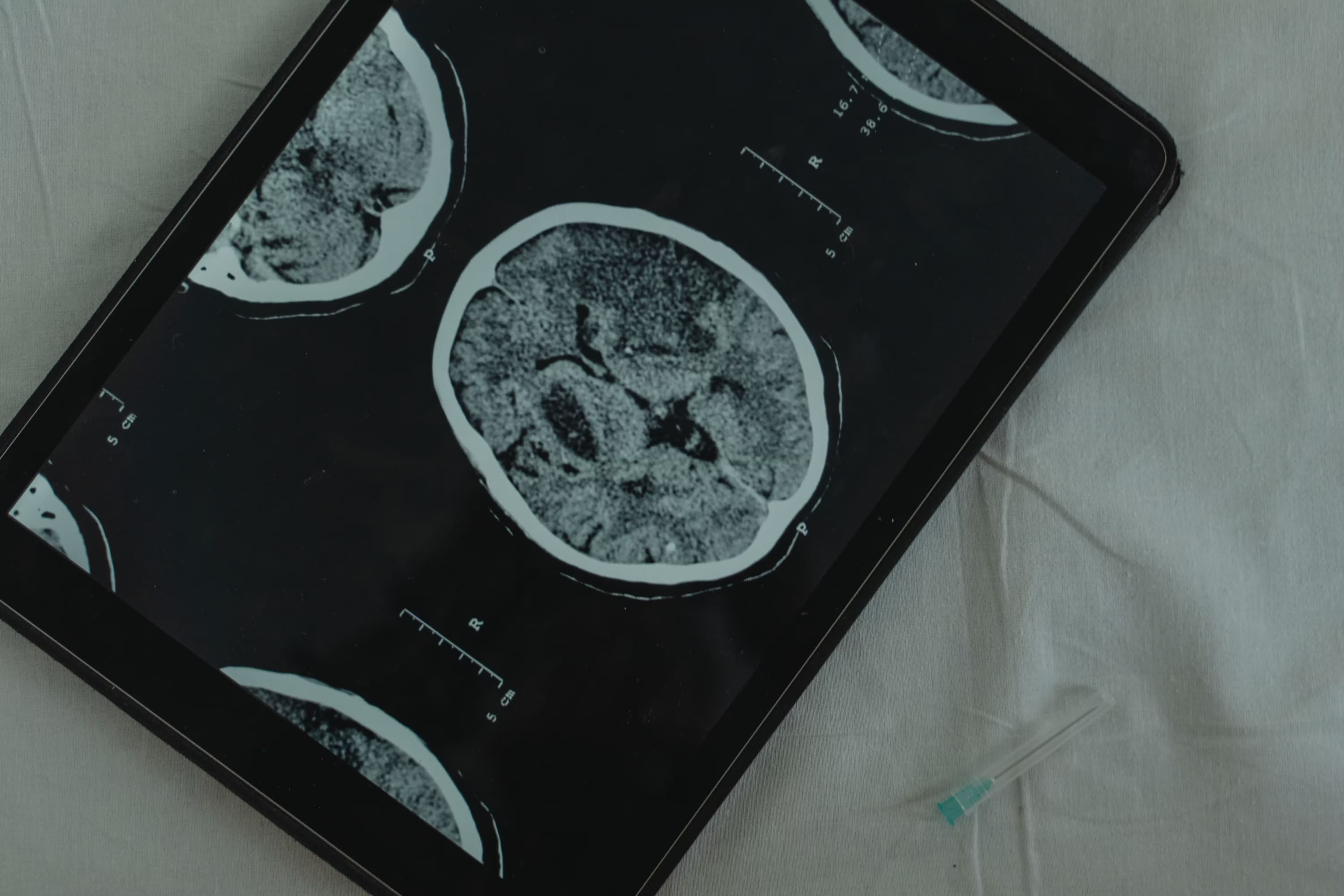 Neurology department at Riverside General Hospital